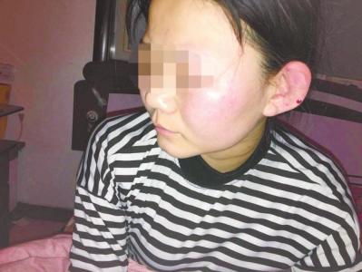  只因“看你不顺眼” 洛阳15岁少女半夜遭多名女生围殴